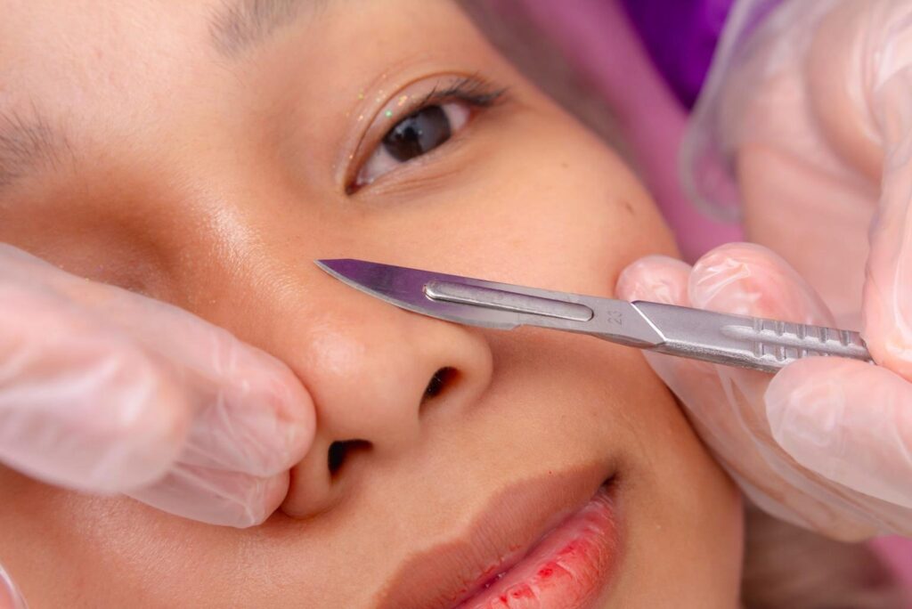 Dermaplaning 1 image 11