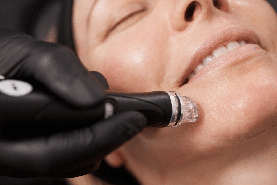 HydraFacial 1 image 2