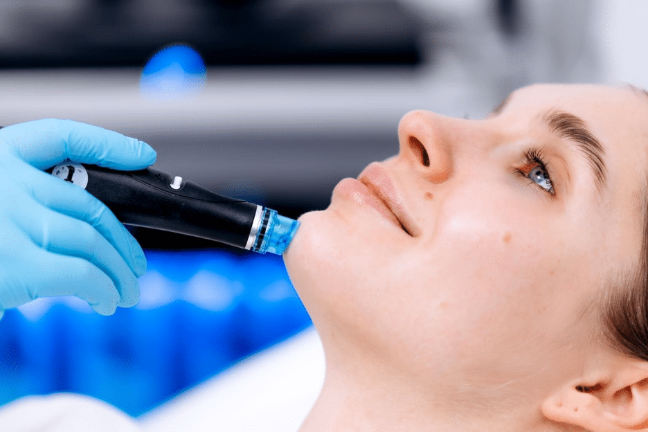 HydraFacial 3 image 3
