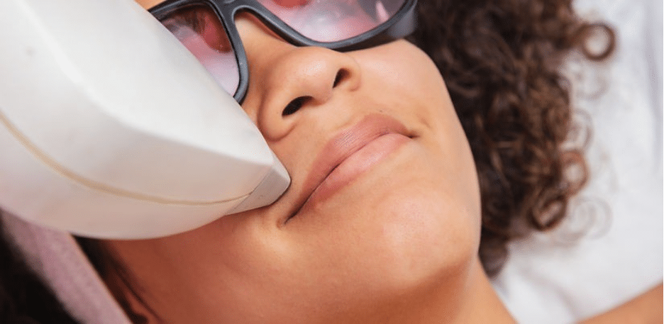 Laser Hair Removal 2 image 32
